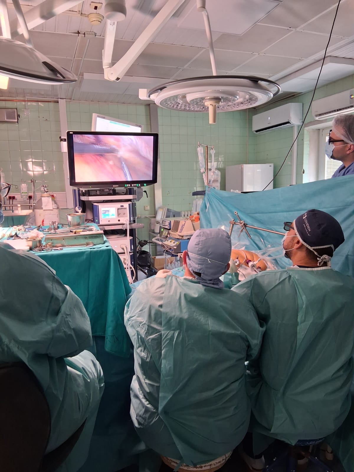 Video-Assisted MICS CABG